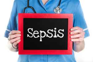 Get educated about sepsis and you might just save a life